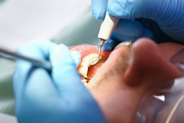 Best Pediatric Emergency Dentist in Forreston, IL