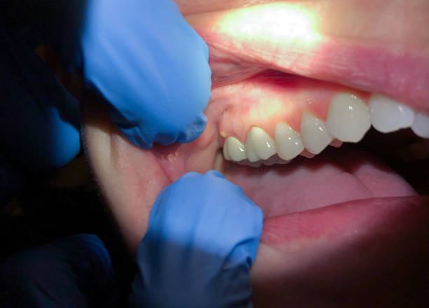 Best Emergency Treatment for Toothache in Forreston, IL