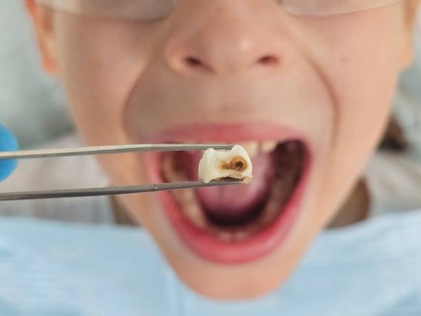 Best Pediatric Emergency Dentist in Forreston, IL